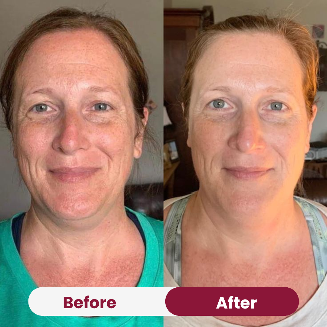 Anti-Wrinkle Collagen Mask 33 109